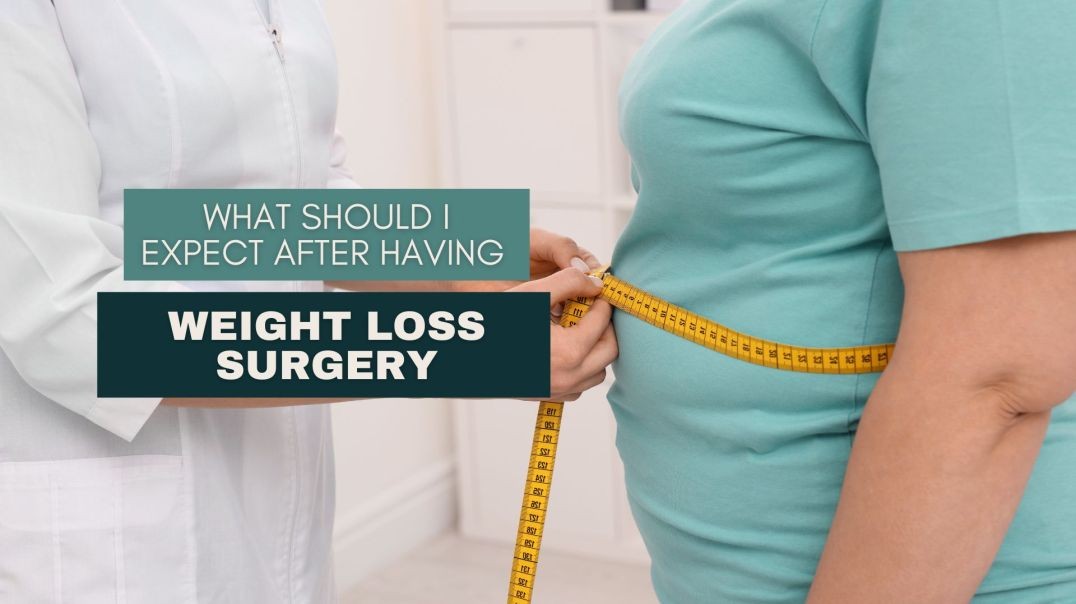 ⁣What Should I Expect After Having Weight Loss Surgery