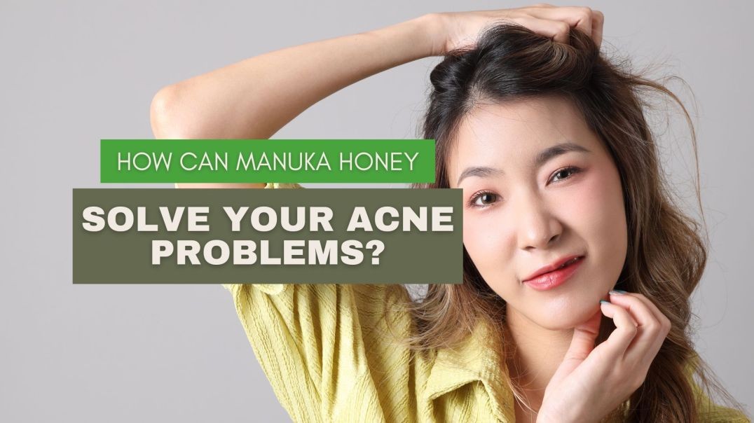 ⁣How Can Manuka Honey Solve Your Acne Problems